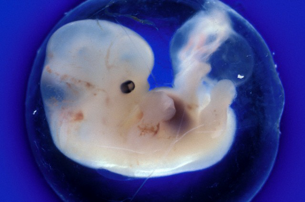 Человеческий эмбрион на 40-м дне развития