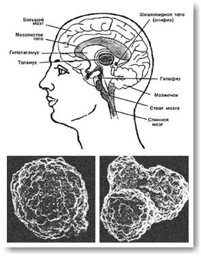 Большой зубной обман. Фтор и шишковидная железа